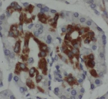 TMPRSS4 Rabbit Polyclonal Antibody