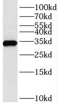 TMX2 Rabbit Polyclonal Antibody