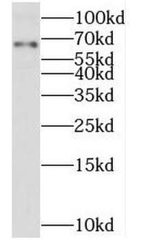 TMX3 Rabbit Polyclonal Antibody