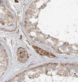 TMX3 Rabbit Polyclonal Antibody