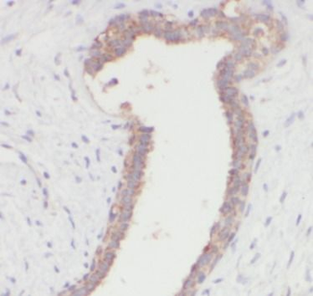 TNF alpha Mouse Monoclonal Antibody