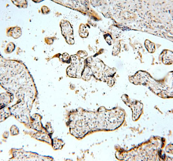 TNFAIP1 Rabbit Polyclonal Antibody