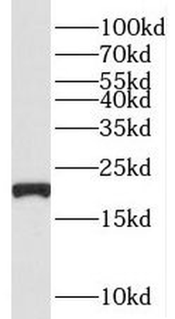 TNFAIP8L2 Rabbit Polyclonal Antibody