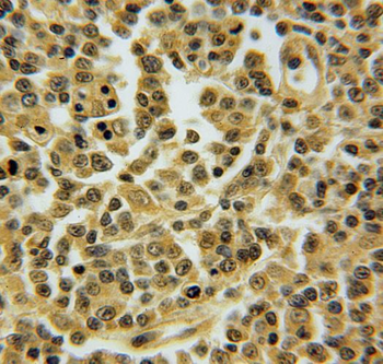 TNFAIP8L2 Rabbit Polyclonal Antibody