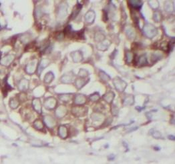 TNF alpha Rabbit Polyclonal Antibody