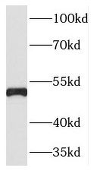TNFRSF1A Rabbit Polyclonal Antibody