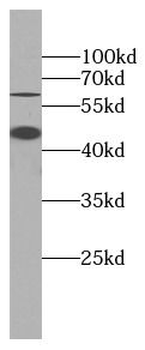 TNFRSF1A Mouse Monoclonal Antibody