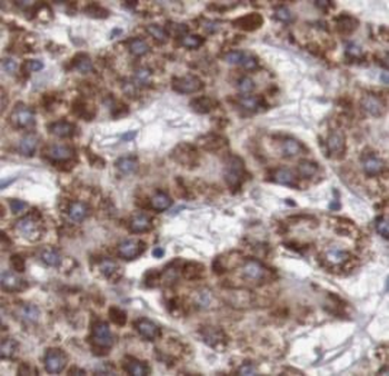 TNFRSF1A Mouse Monoclonal Antibody