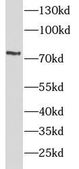 TNFRSF1B Rabbit Polyclonal Antibody