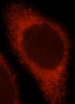 TNFRSF1B Rabbit Polyclonal Antibody