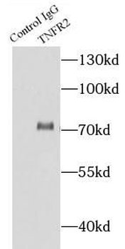 TNFRSF1B Rabbit Polyclonal Antibody