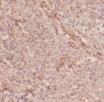 TNFRSF1B Rabbit Polyclonal Antibody