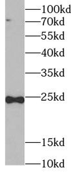 TNFSF12 Rabbit Polyclonal Antibody