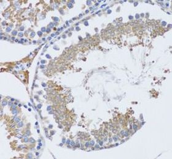 TNFSF12 Rabbit Polyclonal Antibody