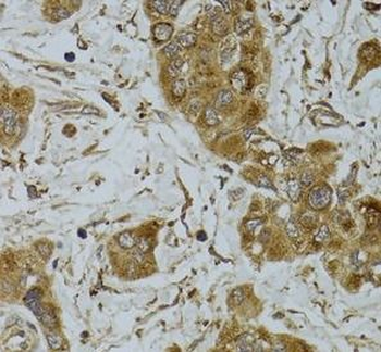 TNFSF13 Rabbit Polyclonal Antibody