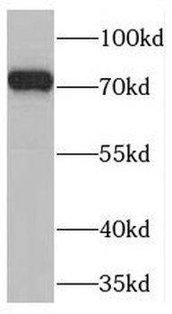 TNIP1 Rabbit Polyclonal Antibody
