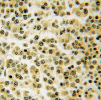 TNIP1 Rabbit Polyclonal Antibody