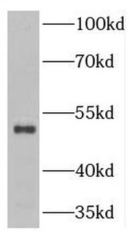 TNIP2 Rabbit Polyclonal Antibody