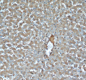 TNIP2 Rabbit Polyclonal Antibody