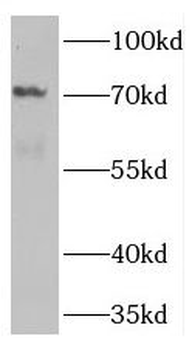 TNK1 Rabbit Polyclonal Antibody