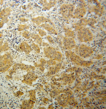 TNK1 Rabbit Polyclonal Antibody