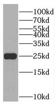 TNNI1 Rabbit Polyclonal Antibody