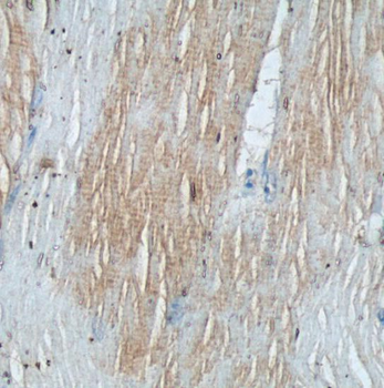 TNNI1 Rabbit Polyclonal Antibody