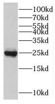 TNNI1 Rabbit Polyclonal Antibody