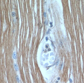 TNNI1 Rabbit Polyclonal Antibody