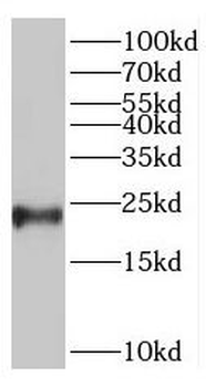 TNNI2 Rabbit Polyclonal Antibody