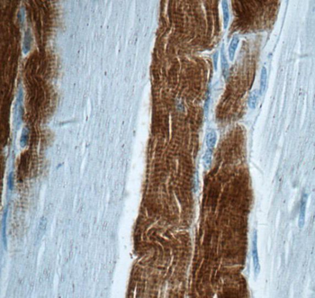 TNNI2 Rabbit Polyclonal Antibody