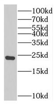 TNNI2 Rabbit Polyclonal Antibody