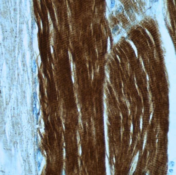 TNNI2 Rabbit Polyclonal Antibody