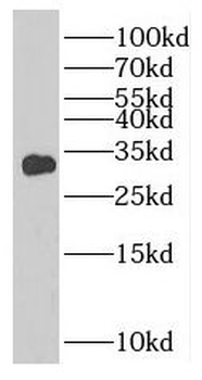 TNNT1 Rabbit Polyclonal Antibody