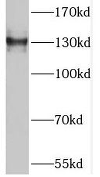 TNS3 Rabbit Polyclonal Antibody