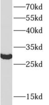 TOLLIP Rabbit Polyclonal Antibody