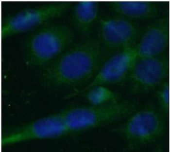 TOLLIP Rabbit Polyclonal Antibody