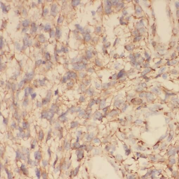TOLLIP Rabbit Polyclonal Antibody