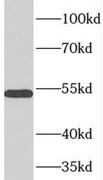 TOM1L1 Rabbit Polyclonal Antibody