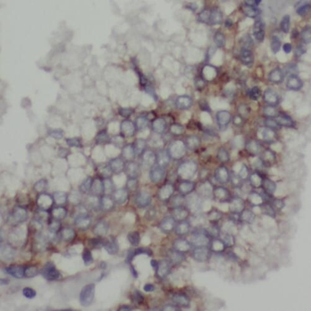 TOM1L1 Rabbit Polyclonal Antibody