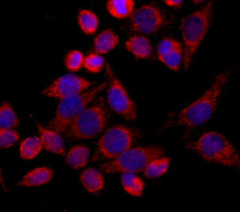 TOMM20 Rabbit Polyclonal Antibody