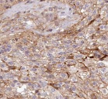 TOMM20 Rabbit Polyclonal Antibody