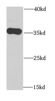 TOMM34 Rabbit Polyclonal Antibody