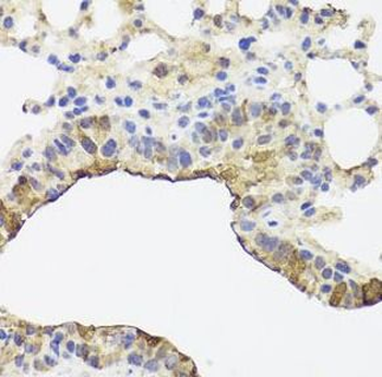 TOMM34 Rabbit Polyclonal Antibody