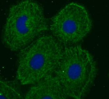 TOR1AIP2 Rabbit Polyclonal Antibody