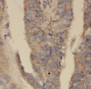 TOR1A Rabbit Polyclonal Antibody
