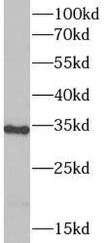 PLAT Rabbit Polyclonal Antibody