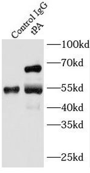 PLAT Rabbit Polyclonal Antibody