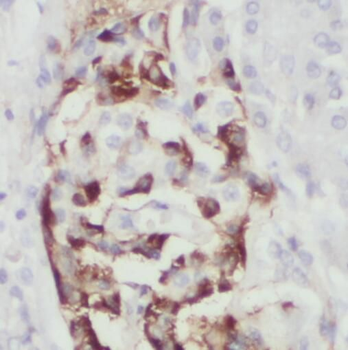 PLAT Rabbit Polyclonal Antibody