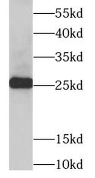 TPI1 Rabbit Polyclonal Antibody